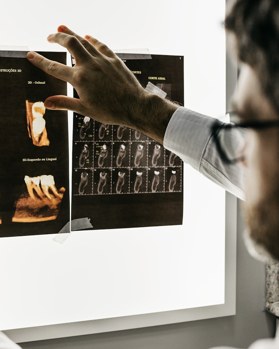 Dentist reviewing 3D dental imaging and CBCT scans