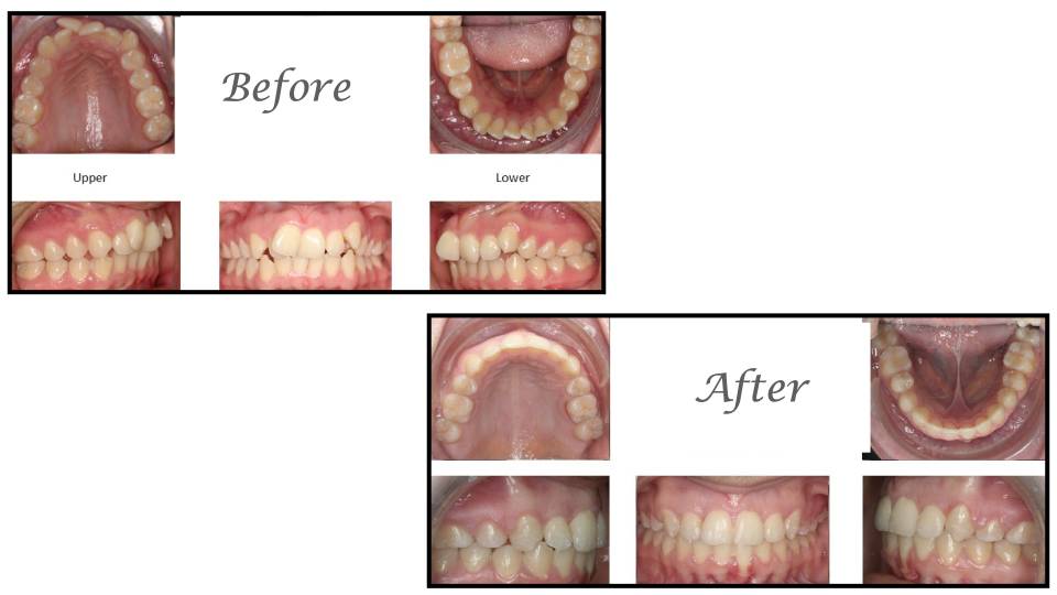 Patient case study