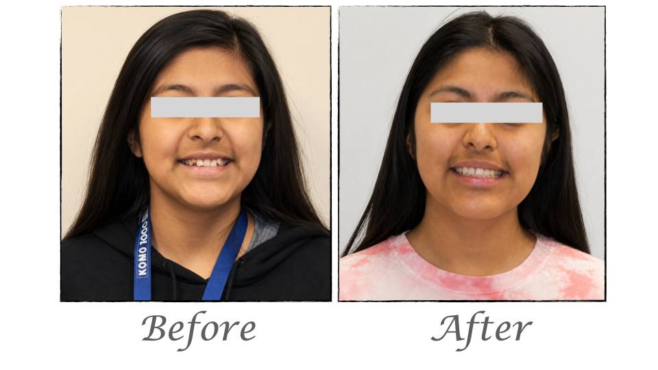 Patient case study