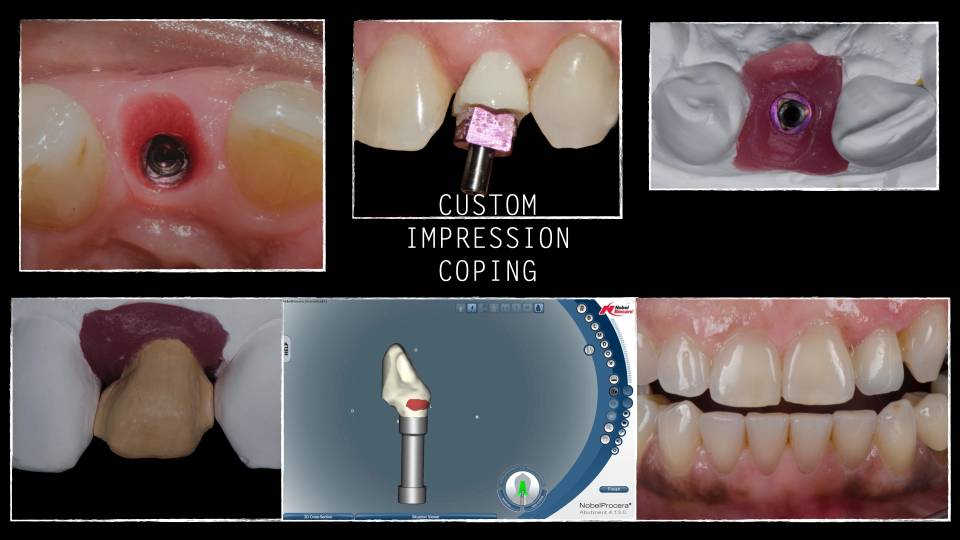 Patient case study
