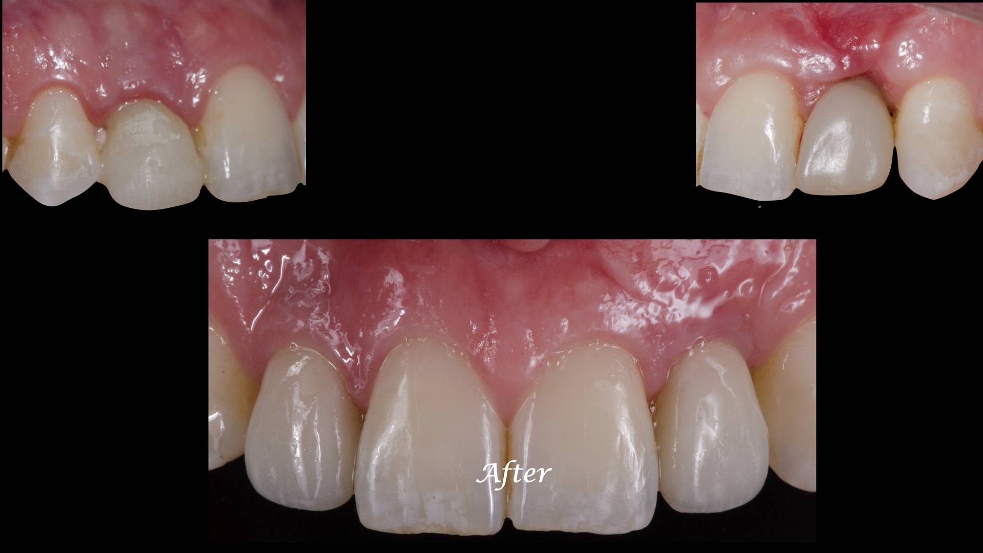 Patient case study