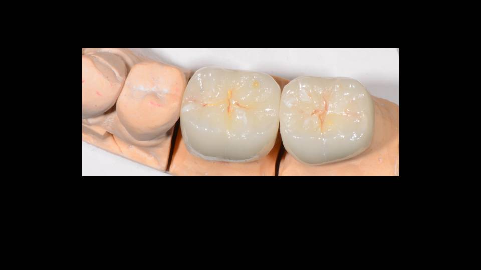 Patient case study
