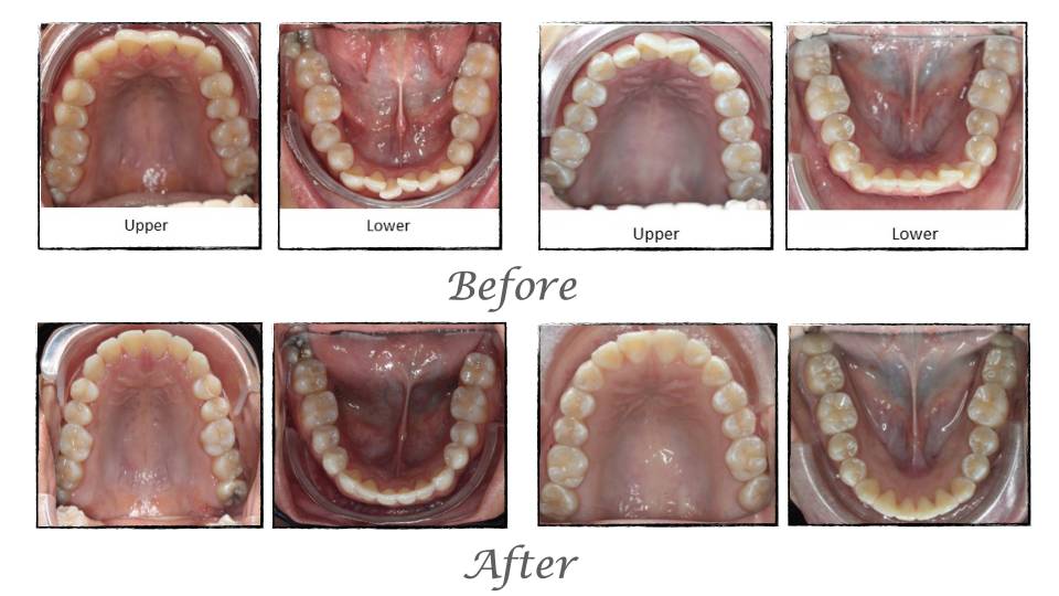 Patient case study