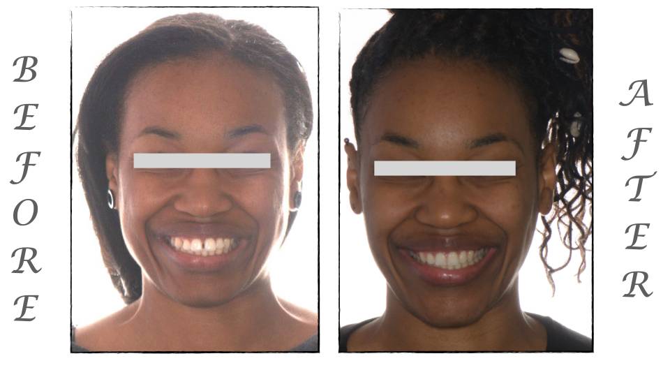 Patient case study