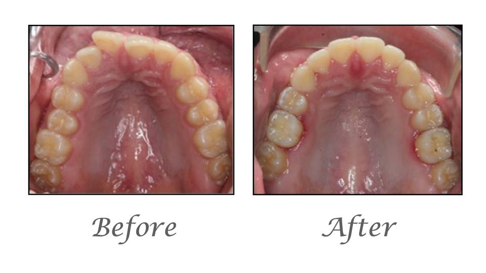 Patient case study