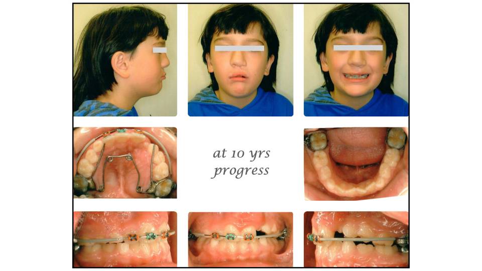 Patient case study