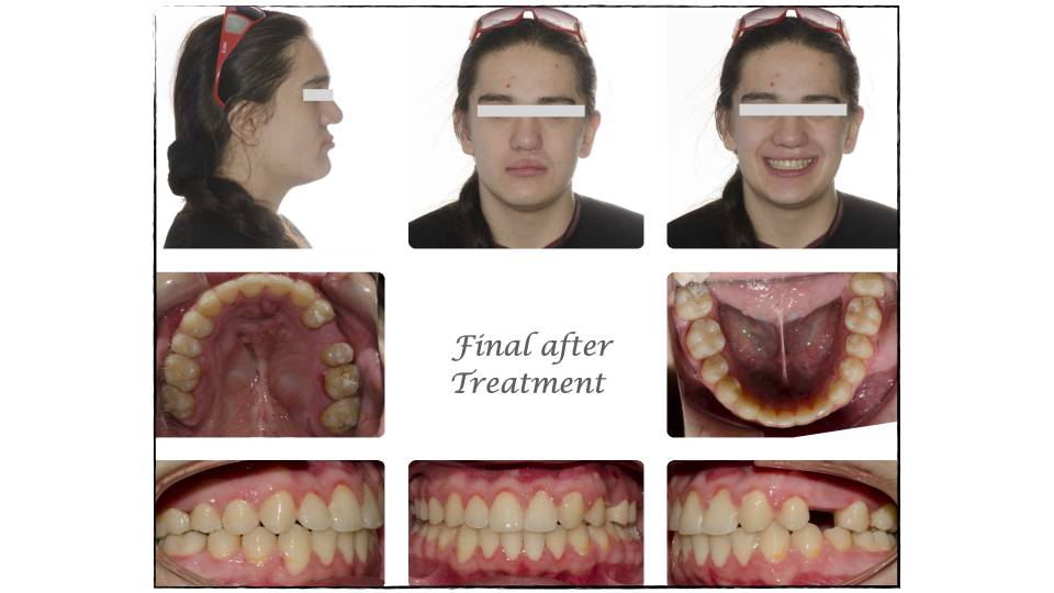 Patient case study