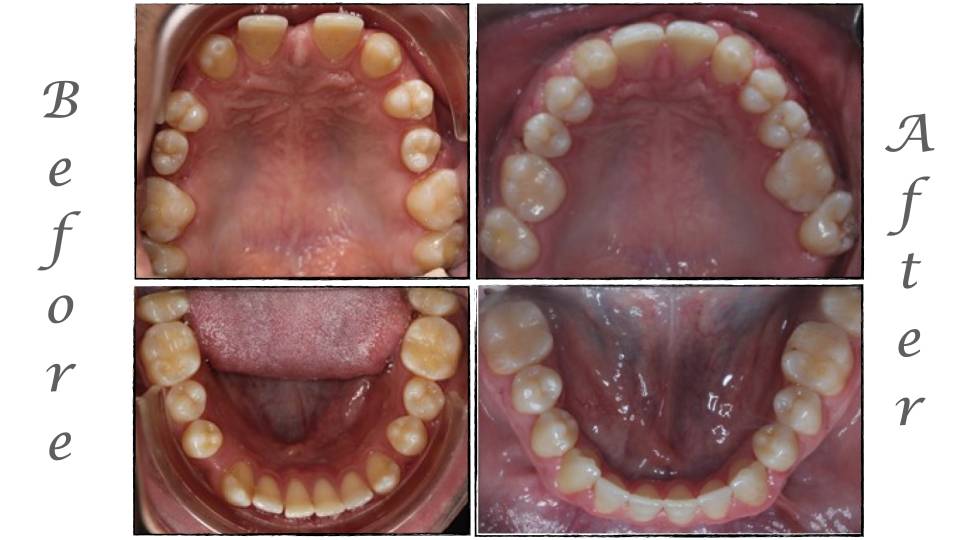 Patient case study