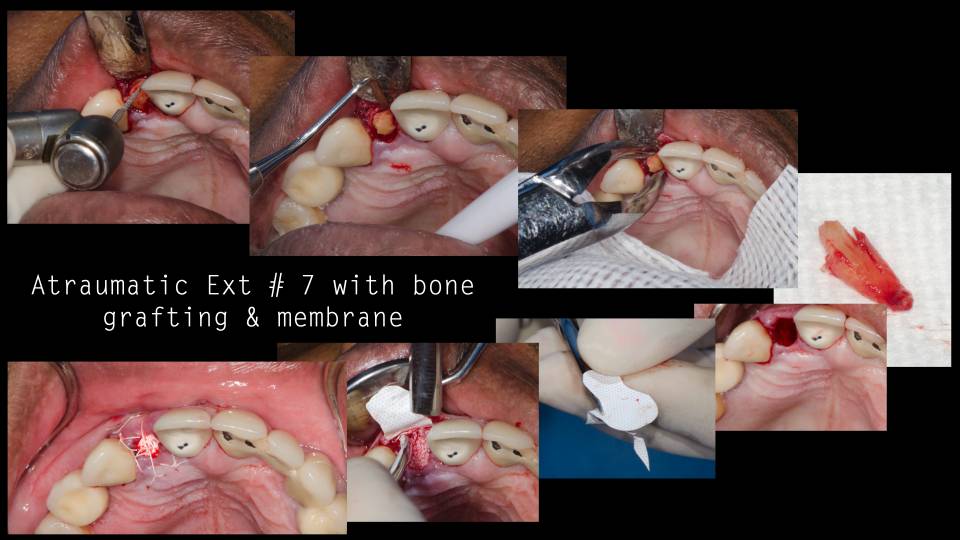 Patient case study