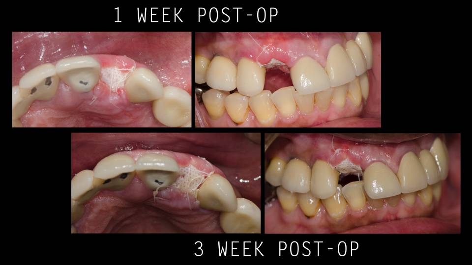 Patient case study
