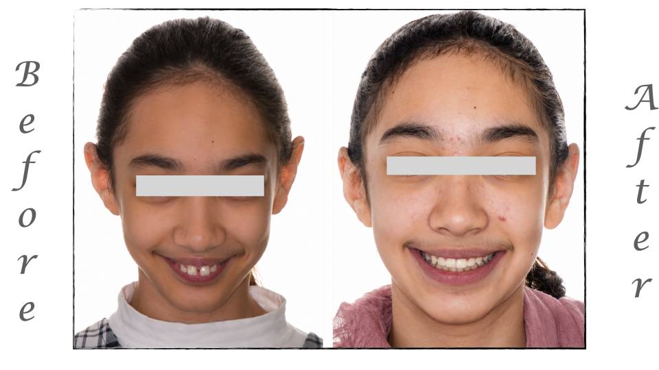 Patient case study