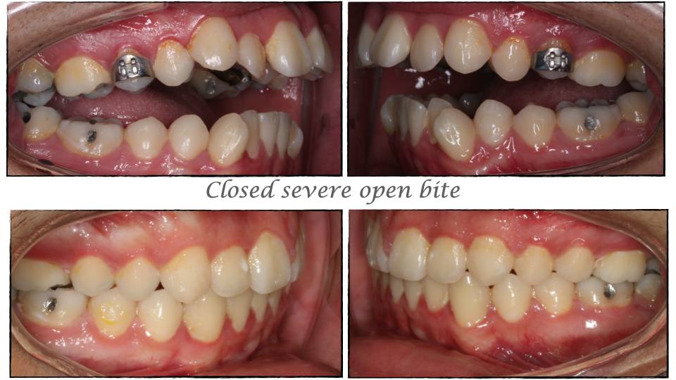Patient case study
