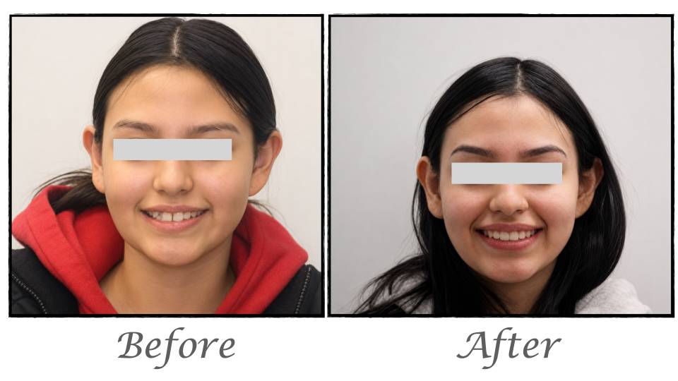 Patient case study