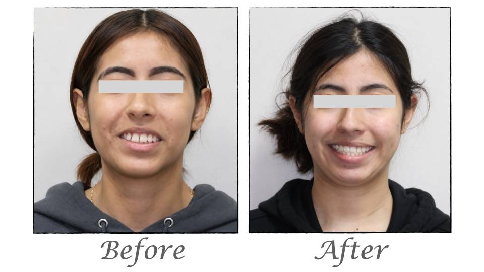 Patient case study