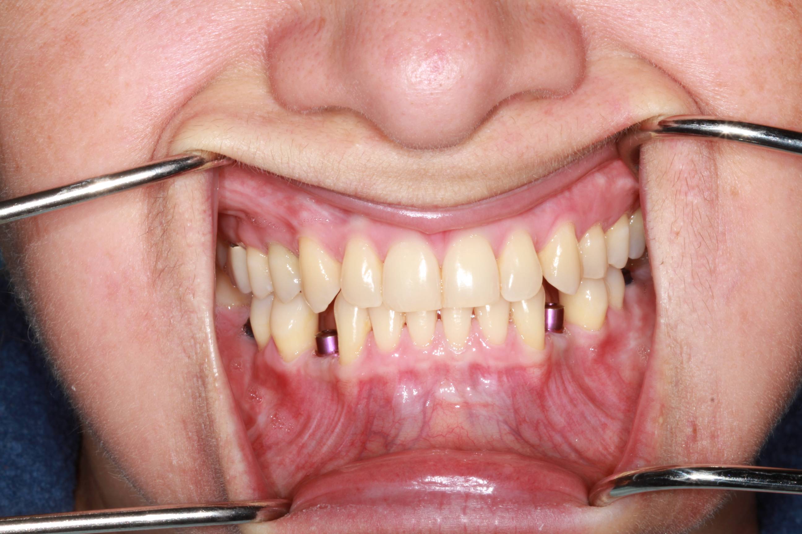 Patient case study