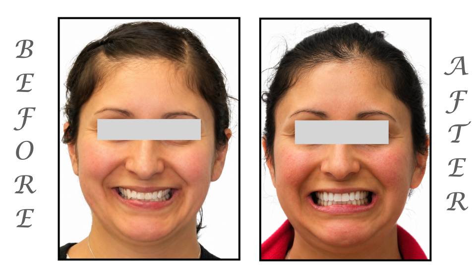 Patient case study