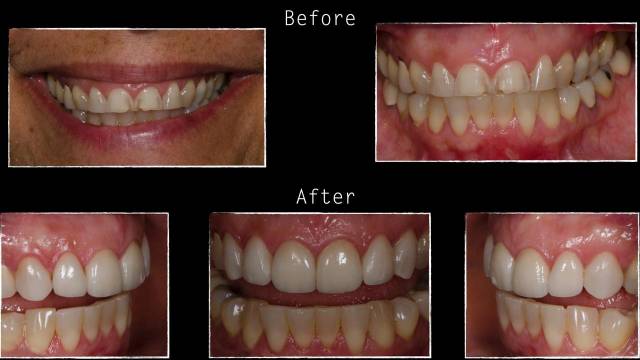 Patient case study