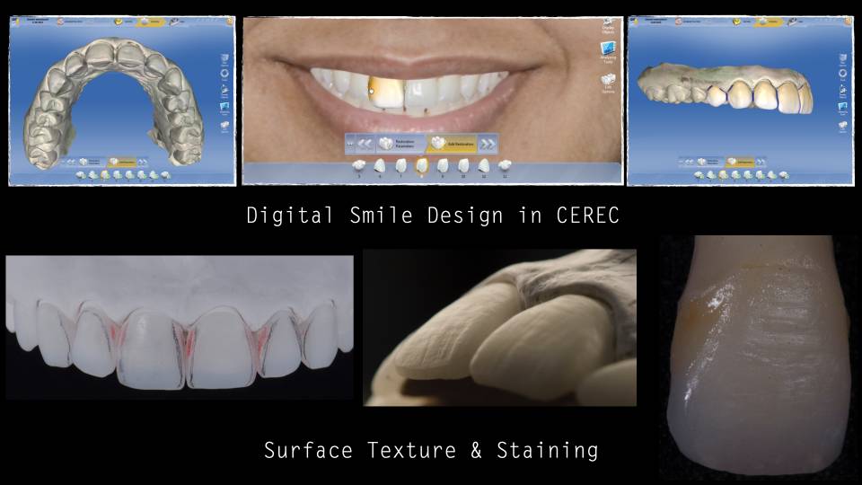 Patient case study