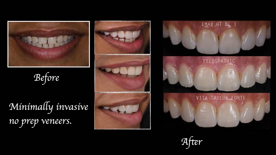 Patient case study
