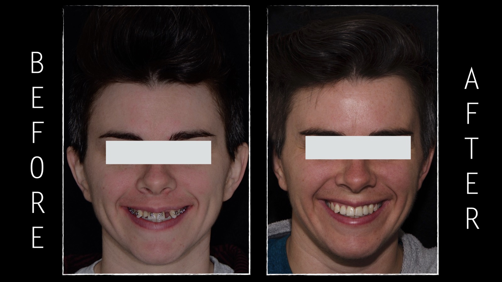 Dental implant case